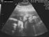 Baby--2-30w2d001_72x54_c